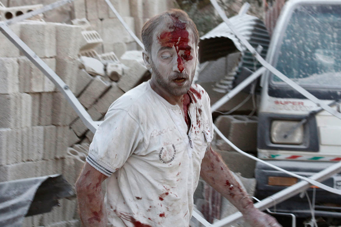 An injured man reacts at a site hit by what activists said were two barrel bombs dropped by forces loyal to Syria's President Bashar al-Assad in the Qadi Askar district of Aleppo