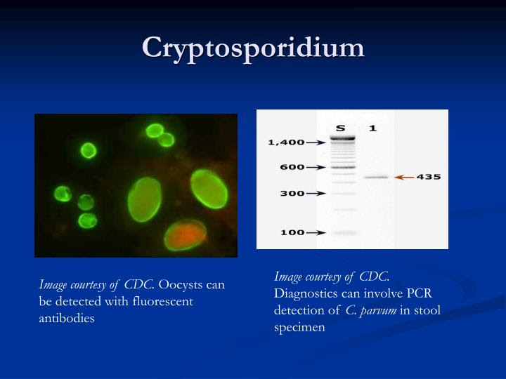 PPT - GASTROINTESTINAL SYSTEM PROTOZOA -II- PowerPoint ...