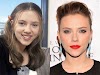 Scarlett Johansson Before Surgery
