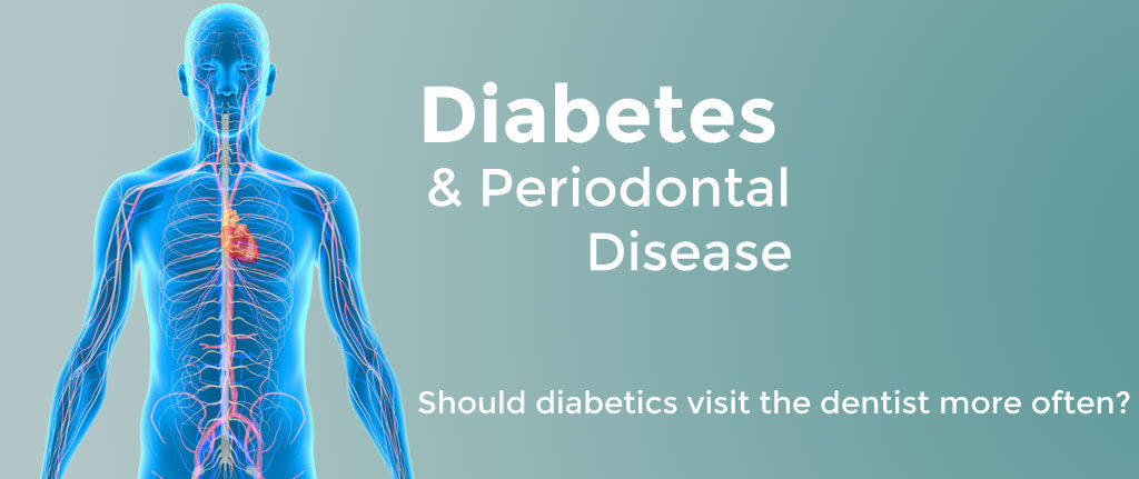 Diabetes and Periodontal Disease: An Update for Health