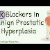 What Are the Benefits of Taking Alpha-Blockers for an Enlarged Prostate?