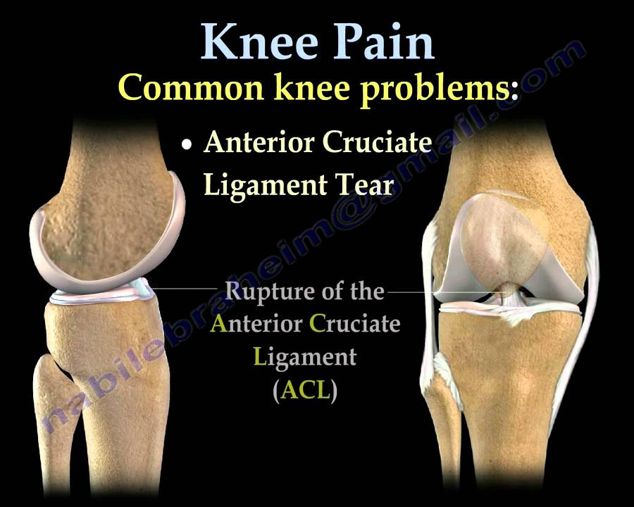 Knee Pain , common causes Everything You Need To Know