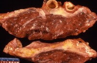 mesothelioma regulation firms specializing