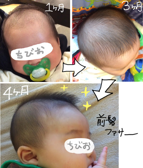 赤ちゃん 薄毛 その ついでに絶壁 ちびお日記