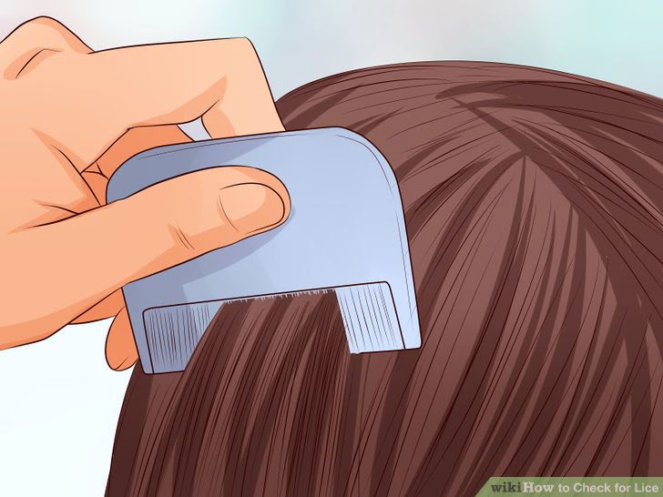 Check for Lice Step 19.jpg