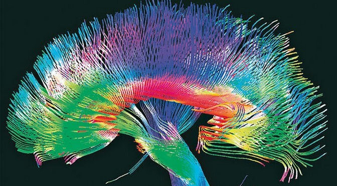 Human Brain Project