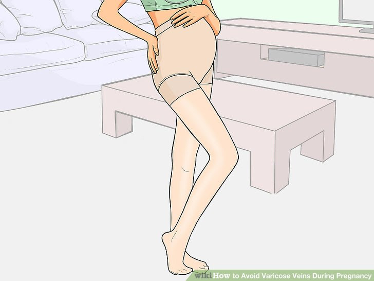 Avoid Varicose Veins During Pregnancy Step 6 Version 2.jpg