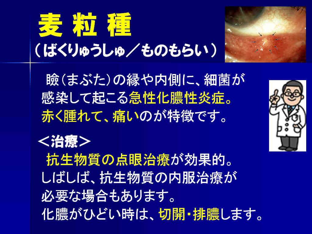 よくある外眼部の病気