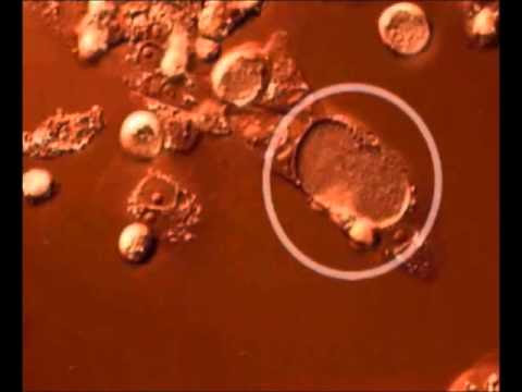 report time for cycle video lapse the Chlamydia Time of trachomatis report time for cycle video lapse the Chlamydia Time of trachomatis