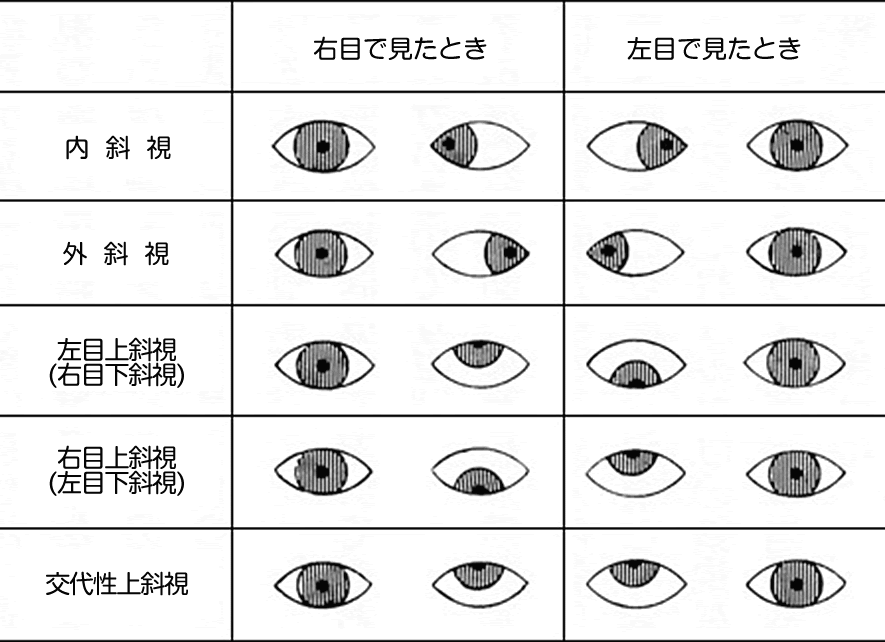 小児眼科 昴会アイセンター Subarukai Eye Center
