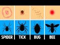Find Out 39+ Facts Of Spider That Looks Like Tick  They Forgot to Let You in!