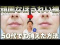 √70以上 ほう れい 線 消える クリーム 145322-ほう れい 線 消える クリーム