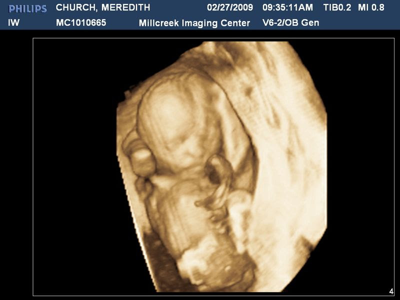 CHURCHMEREDITH20090227093511793