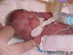 Lindsey - 4 days old