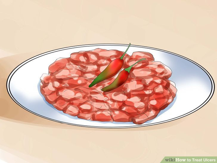 Treat Ulcers Step 11.jpg