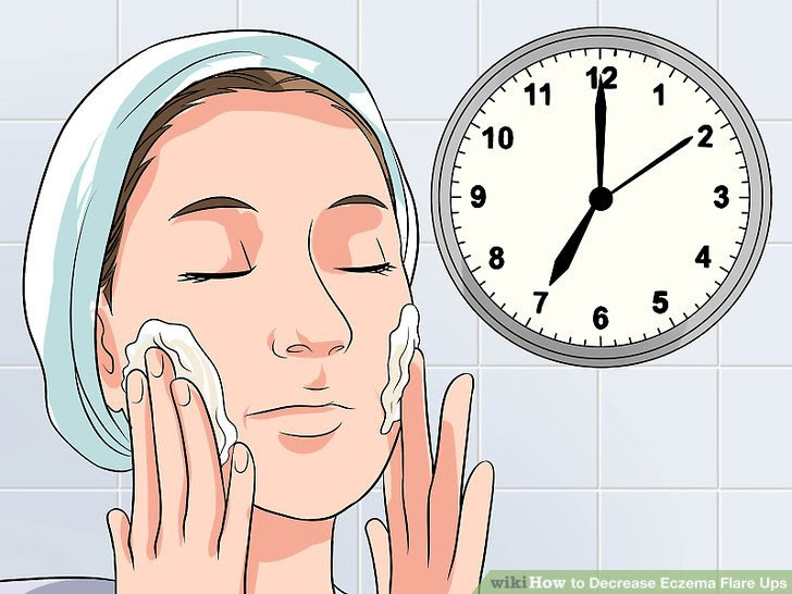 Decrease Eczema Flare Ups Step 12 Version 3.jpg