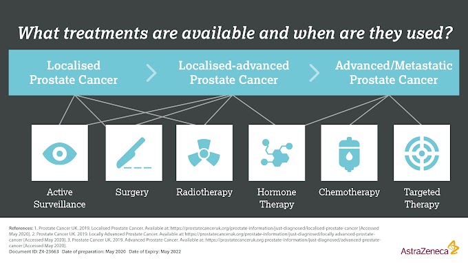 Prostate Cancer Staging Treatment / Management Of Early Stage Prostate Cancer / Bone metastasis and prostate cancer.
