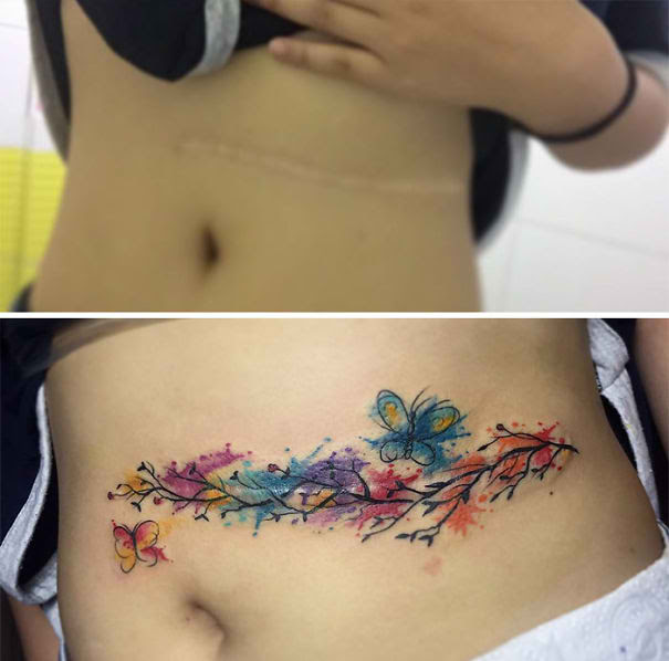 LOOK: Tattoo Artists Create A Masterpiece By Covering Up These Huge Scars With A Stunning Tattoo!