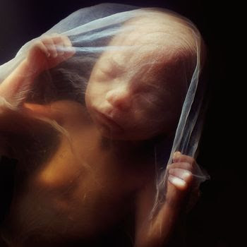 16 week  abortion