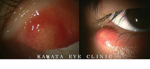 河田眼科医院 Eye Clinic Kawata