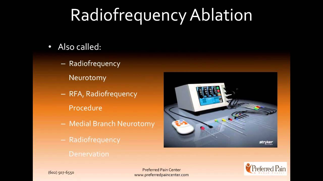Radiofrequency Ablation (Radiofrequency Neurotomy) for Low ...