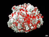 Cell infected with HIV
