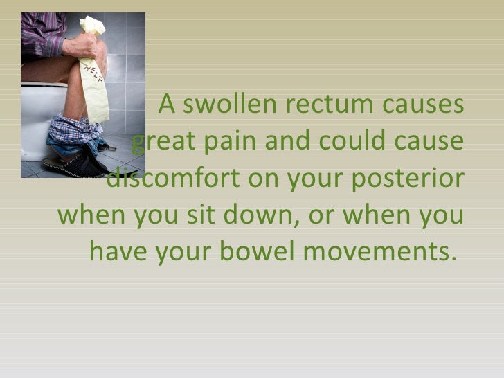 hemorrhoids external
