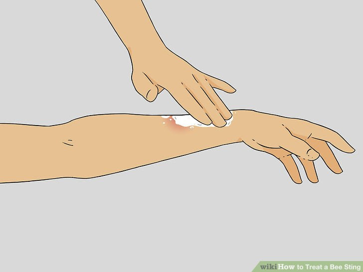 Treat a Bee Sting Step 9 Version 3.jpg