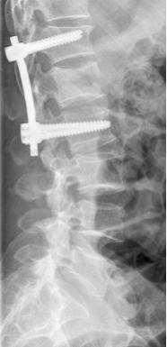 骨一科 外科系统 伊川县人民医院