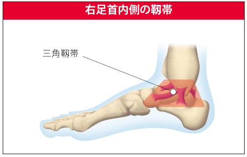 三角靭帯損傷 ちょっとずつ進歩 超初心者のランニング日記