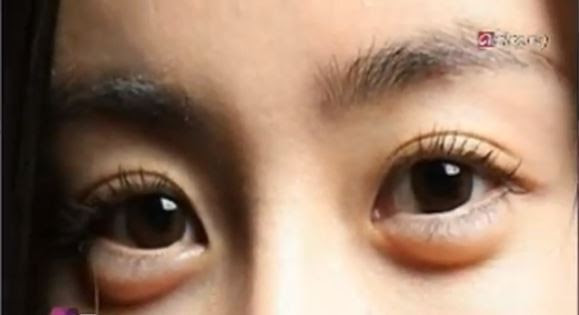 money make drawing how Make to Eyes Women Have Aegyo Puffy Sal: Korean Surgery money make drawing how Make to Eyes Women Have Aegyo Puffy Sal: Korean Surgery