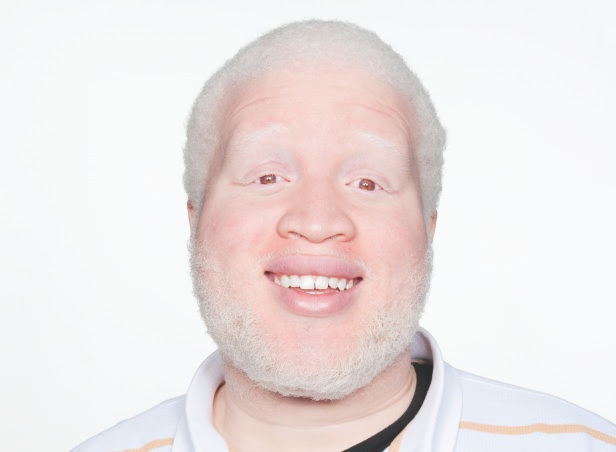 Albinos are probably white mice, rats and rabbits, which we all know 