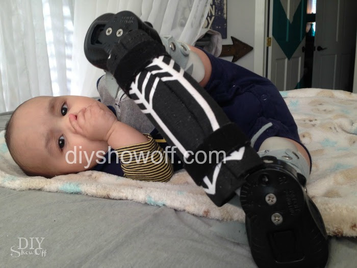 Diy Club Foot Brace Coverdiy Show Off Diy Decorating And Home Improvement Blog