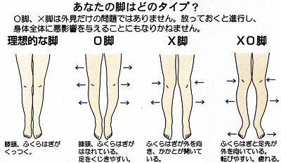 吹田市の五月が丘で腰痛 スポーツ障害 スポーツ整体はアクア五月が丘整骨院