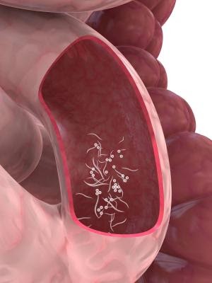 Prostate Cancer Symptoms Come And Go : Osteonecrosis of the Jaw in Cancer Patients