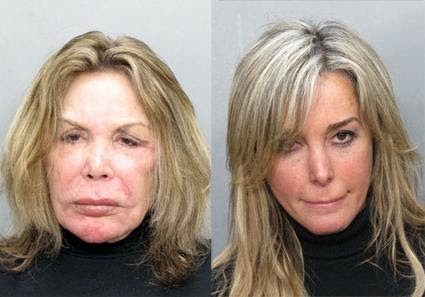 Mother/Daughter Mug Shots