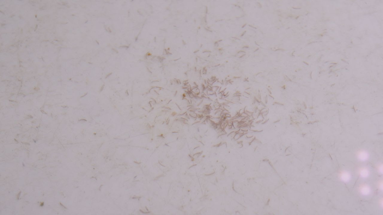 気持ちがいいほど 良く取れた寄生虫 やはり淡水浴 寄生虫 害虫について 海水魚のパイオニア 日海センター 日海フィッシュコム