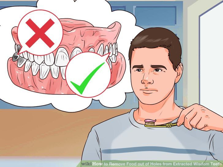 Remove Food out of Holes from Extracted Wisdom Teeth Step 2 Version 3.jpg