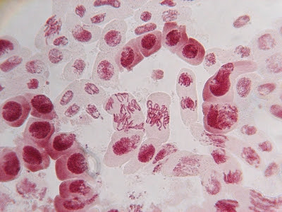タマネギの細胞分裂を全員が授業で観察する