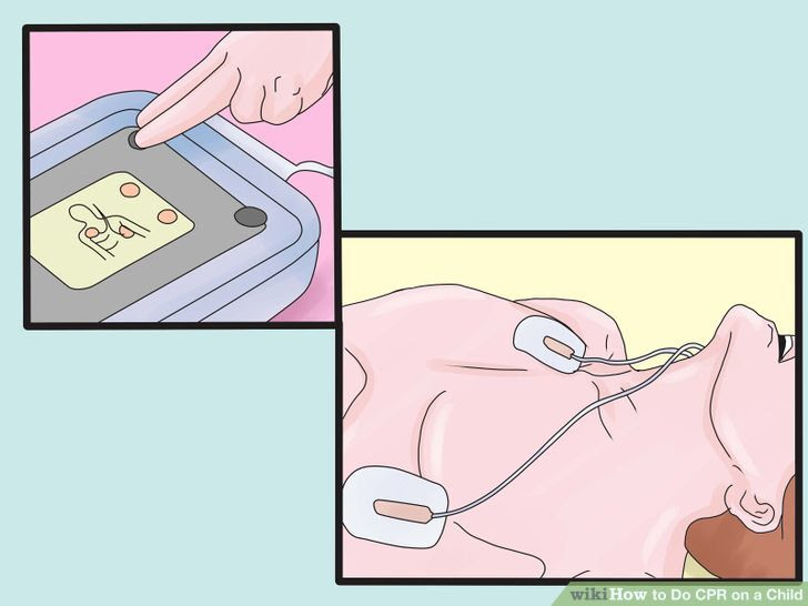 Do CPR on a Child Step 11.jpg