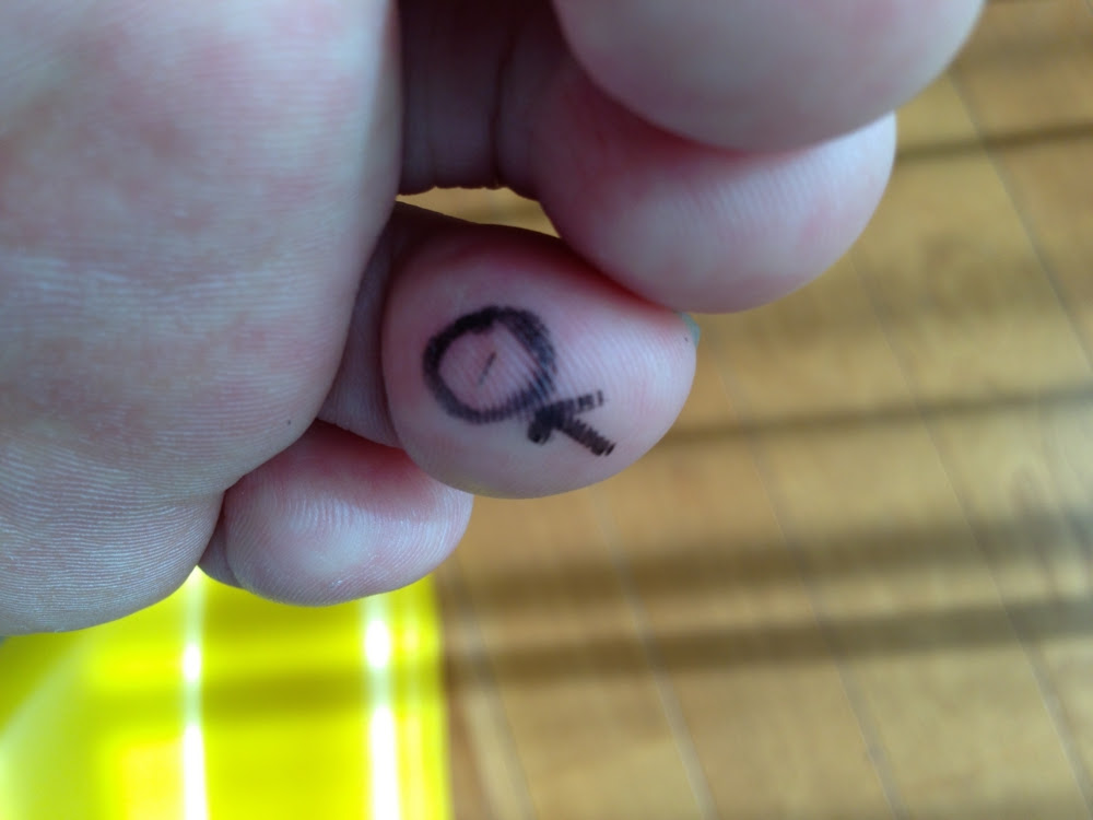 棘が刺さった Tamagoke S Diary