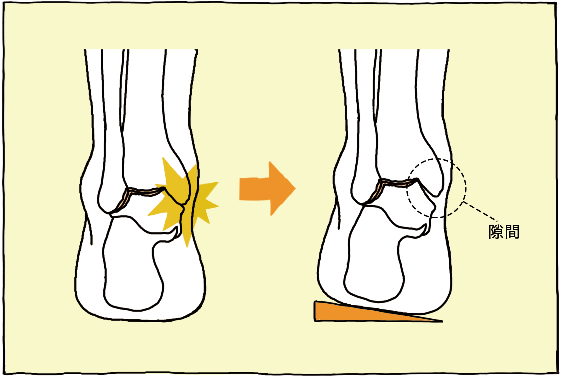 足首が痛い 原因 と 場所 から分類 解説 対処法 足のお悩み百科