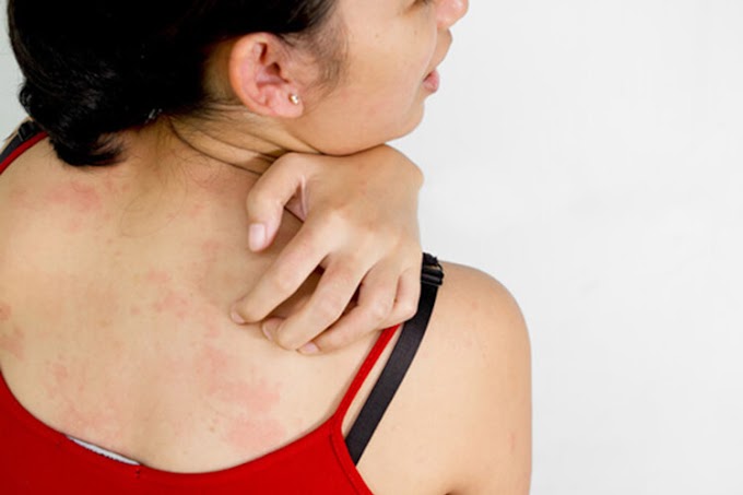 Skin Cancer Symptoms In Hindi : Healthiculture - Skin Rash and Itch in Fibromyalgia - Thyroid cancer symptoms & treatment;