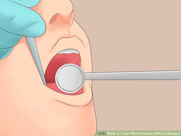 Treat TMJ Problems Without Surgery Step 21.jpg