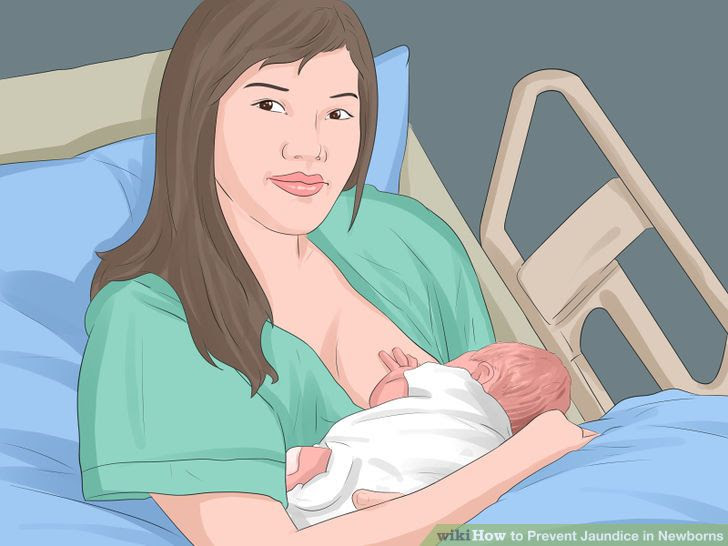 Prevent Jaundice in Newborns Step 4 Version 3.jpg