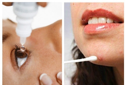 Thuốc nhỏ mắt có khả năng kháng viêm giúp trị mụn hiệu quả