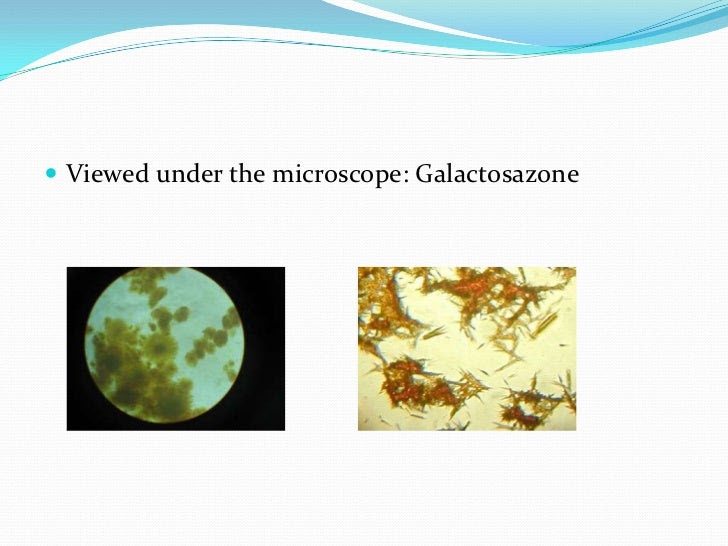 osazone fructose structure test Osazone osazone fructose structure test Osazone