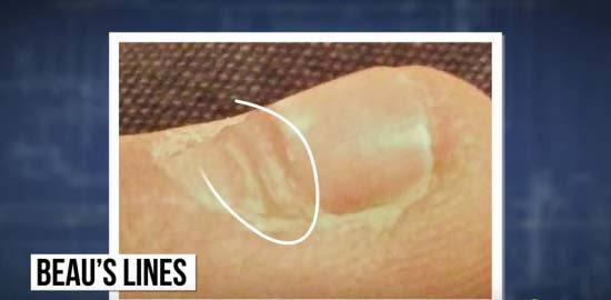 爪に表れる体の異変 5つの症状を解説 ログミーbiz