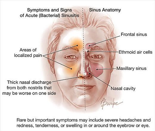 sinus problems light headed