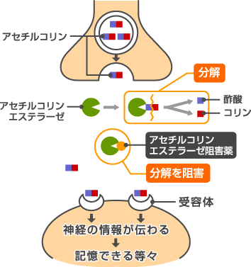 aki 腎臓 原因